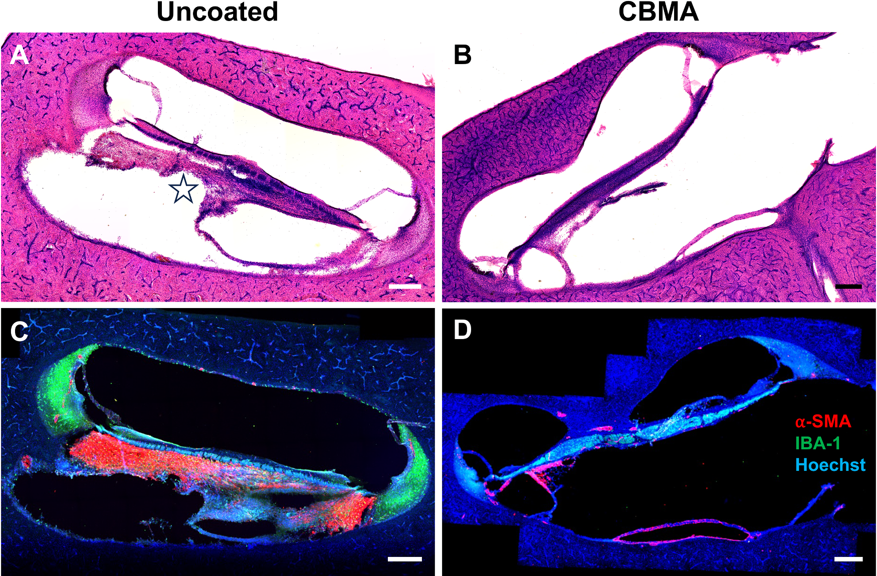 Four sections of a sheep cochlea. The left column shows an uncoated array site with dense tissue in the scala. The right column shows a coated array site with much less tissue. The top row is H and E stain and the bottom row is immunostaining.